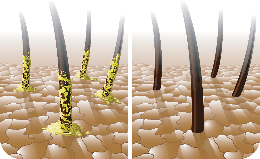 残留薬剤のケミカルケア
