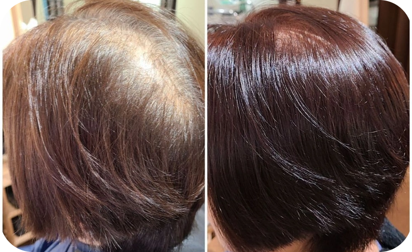 加齢による髪質のヘアケア