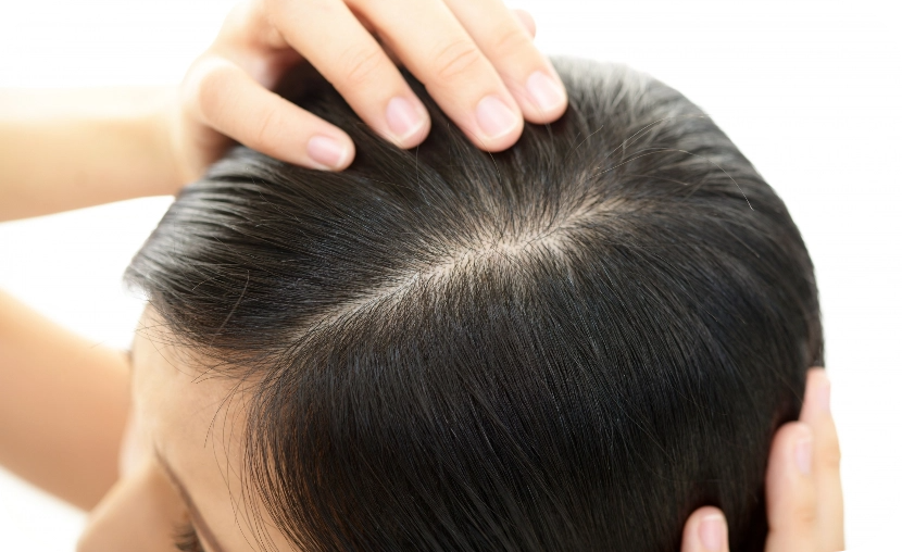 頭皮の保湿で弾力UP