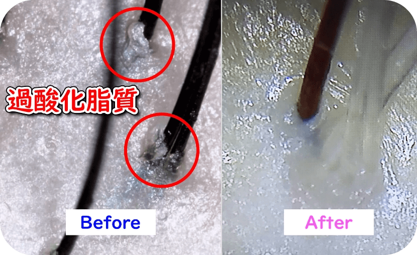 頭皮と髪のエイジングケア